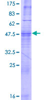 OR52E4 Protein - 12.5% SDS-PAGE of human OR52E4 stained with Coomassie Blue