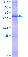 OR52N4 Protein - 12.5% SDS-PAGE of human OR52N4 stained with Coomassie Blue