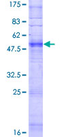 OR5A2 Protein - 12.5% SDS-PAGE of human OR5A2 stained with Coomassie Blue