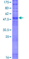 OR5C1 Protein - 12.5% SDS-PAGE of human OR5C1 stained with Coomassie Blue