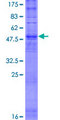 OR5C1 Protein - 12.5% SDS-PAGE of human OR5C1 stained with Coomassie Blue