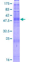 OR5D14 Protein - 12.5% SDS-PAGE of human OR5D14 stained with Coomassie Blue