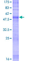 OR5F1 Protein - 12.5% SDS-PAGE of human OR5F1 stained with Coomassie Blue