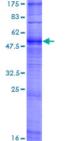 OR5H1 Protein - 12.5% SDS-PAGE of human OR5H1 stained with Coomassie Blue