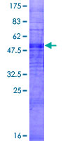 OR5H6 Protein - 12.5% SDS-PAGE of human OR5H6 stained with Coomassie Blue