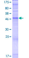 OR5J2 Protein - 12.5% SDS-PAGE of human OR5J2 stained with Coomassie Blue