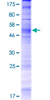 OR5K1 Protein - 12.5% SDS-PAGE of human OR5K1 stained with Coomassie Blue