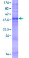 OR5P2 Protein - 12.5% SDS-PAGE of human OR5P2 stained with Coomassie Blue