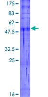 OR5R1 Protein - 12.5% SDS-PAGE of human OR5R1 stained with Coomassie Blue