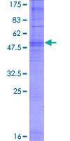 OR5T1 Protein - 12.5% SDS-PAGE of human OR5T1 stained with Coomassie Blue
