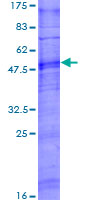 OR5T3 Protein - 12.5% SDS-PAGE of human OR5T3 stained with Coomassie Blue