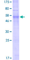 OR5V1 Protein - 12.5% SDS-PAGE of human OR5V1 stained with Coomassie Blue