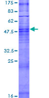OR6B2 Protein - 12.5% SDS-PAGE of human OR6B2 stained with Coomassie Blue