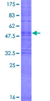 OR6C75 Protein - 12.5% SDS-PAGE of human OR6C75 stained with Coomassie Blue