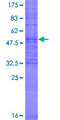 OR6C75 Protein - 12.5% SDS-PAGE of human OR6C75 stained with Coomassie Blue