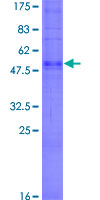 OR6C76 Protein - 12.5% SDS-PAGE of human OR6C76 stained with Coomassie Blue