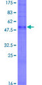 OR6C76 Protein - 12.5% SDS-PAGE of human OR6C76 stained with Coomassie Blue