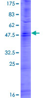 OR6F1 Protein - 12.5% SDS-PAGE of human OR6F1 stained with Coomassie Blue