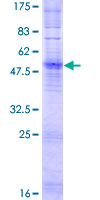 OR6M1 Protein - 12.5% SDS-PAGE of human OR6M1 stained with Coomassie Blue