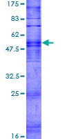 OR6V1 Protein - 12.5% SDS-PAGE of human OR6V1 stained with Coomassie Blue
