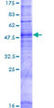 OR7A5 Protein - 12.5% SDS-PAGE of human OR7A5 stained with Coomassie Blue