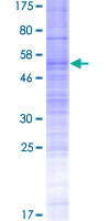 OR7C2 Protein - 12.5% SDS-PAGE of human OR7C2 stained with Coomassie Blue