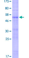 OR7D2 Protein - 12.5% SDS-PAGE of human OR7D2 stained with Coomassie Blue