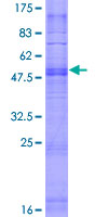 OR7G2 Protein - 12.5% SDS-PAGE of human OR7G2 stained with Coomassie Blue