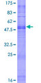 OR7G2 Protein - 12.5% SDS-PAGE of human OR7G2 stained with Coomassie Blue