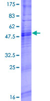 OR8A1 Protein - 12.5% SDS-PAGE of human OR8A1 stained with Coomassie Blue