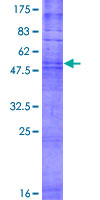 OR8B12 Protein - 12.5% SDS-PAGE of human OR8B12 stained with Coomassie Blue