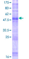 OR8H1 Protein - 12.5% SDS-PAGE of human OR8H1 stained with Coomassie Blue