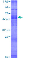 OR8K1 Protein - 12.5% SDS-PAGE of human OR8K1 stained with Coomassie Blue