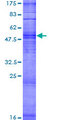 OR8K1 Protein - 12.5% SDS-PAGE of human OR8K1 stained with Coomassie Blue