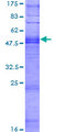 OR9I1 Protein - 12.5% SDS-PAGE of human OR9I1 stained with Coomassie Blue