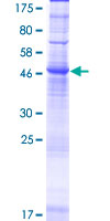 ORAI2 Protein - 12.5% SDS-PAGE of human ORAI2 stained with Coomassie Blue