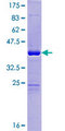 ORAOV1 Protein - 12.5% SDS-PAGE of human ORAOV1 stained with Coomassie Blue