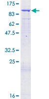 ORC3L / ORC3 Protein - 12.5% SDS-PAGE of human ORC3L stained with Coomassie Blue