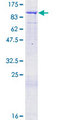 ORC3L / ORC3 Protein - 12.5% SDS-PAGE of human ORC3L stained with Coomassie Blue