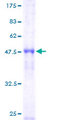 ORC4L / ORC4 Protein - 12.5% SDS-PAGE of human ORC4L stained with Coomassie Blue