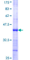 ORC5 Protein
