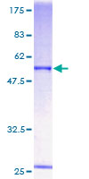 ORC6 / ORC6L Protein - 12.5% SDS-PAGE of human ORC6L stained with Coomassie Blue