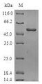 ORC6 / ORC6L Protein - (Tris-Glycine gel) Discontinuous SDS-PAGE (reduced) with 5% enrichment gel and 15% separation gel.