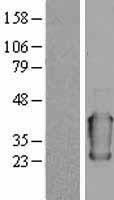 ORM1 / Orosomucoid Protein - Western validation with an anti-DDK antibody * L: Control HEK293 lysate R: Over-expression lysate