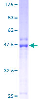 ORM1 / Orosomucoid Protein - 12.5% SDS-PAGE of human ORM1 stained with Coomassie Blue