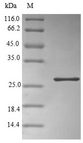 ORM2 / Orosomucoid 2 Protein - (Tris-Glycine gel) Discontinuous SDS-PAGE (reduced) with 5% enrichment gel and 15% separation gel.