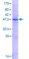 ORM2 / Orosomucoid 2 Protein - 12.5% SDS-PAGE of human ORM2 stained with Coomassie Blue