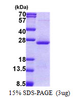ORM2 / Orosomucoid 2 Protein