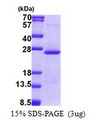 ORM2 / Orosomucoid 2 Protein
