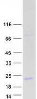 ORM2 / Orosomucoid 2 Protein - Purified recombinant protein ORM2 was analyzed by SDS-PAGE gel and Coomassie Blue Staining